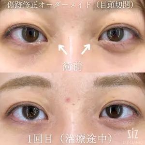 before image