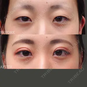 30 days after image