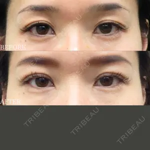 30 days after image