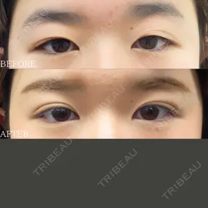 30 days after image