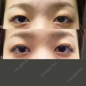 before image
