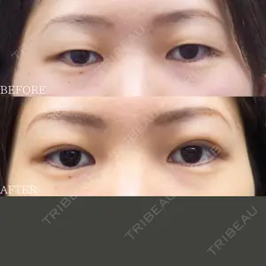 before image