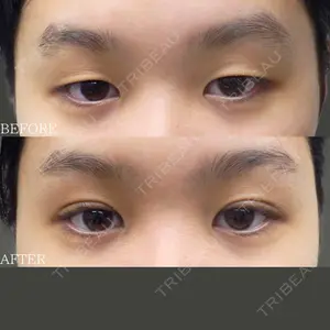 30 days after image