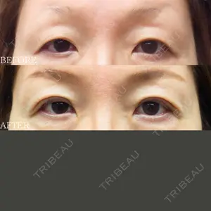 before image