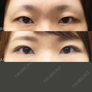 before image