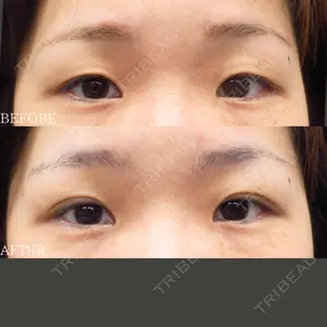 before image