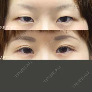 30 days after image