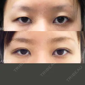 30 days after image