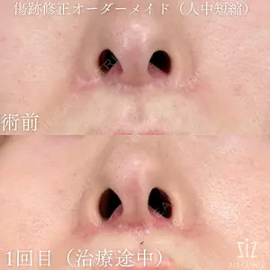 before image