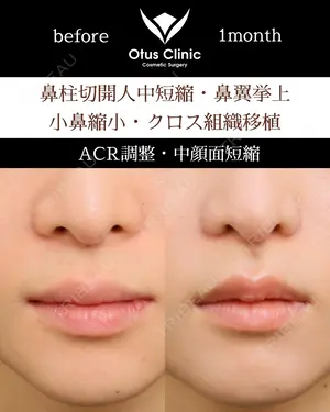 30 days after image