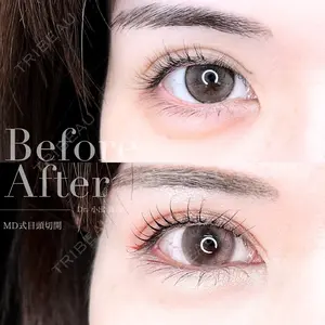 30 days after image