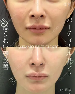 30 days after image