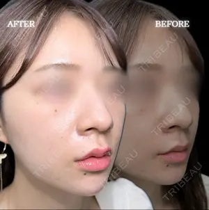 before image