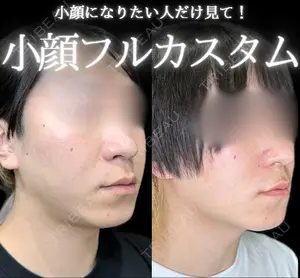 before image