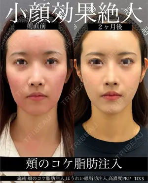 60 days after image