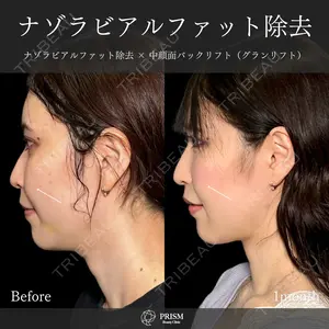 30 days after image