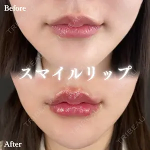before image
