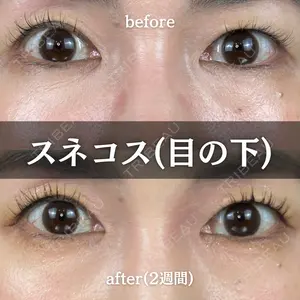 14 days after image