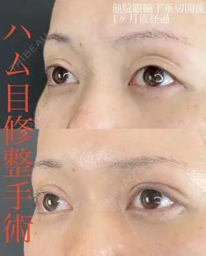 before image