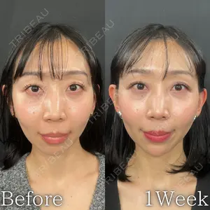 7 days after image