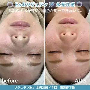 30 days after image
