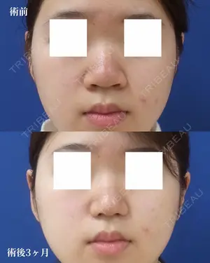 before image