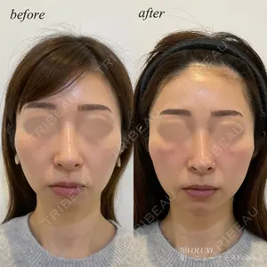 before image