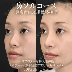 30 days after image