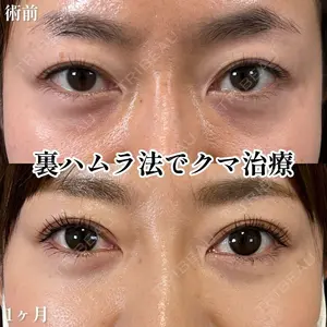 30 days after image
