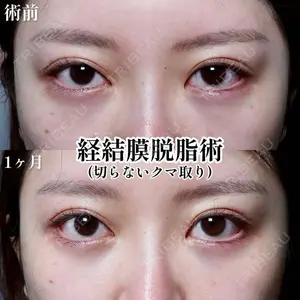 30 days after image