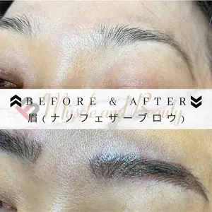 before image