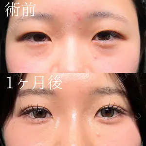30 days after image