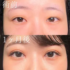 30 days after image