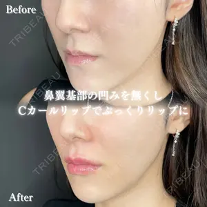 before image