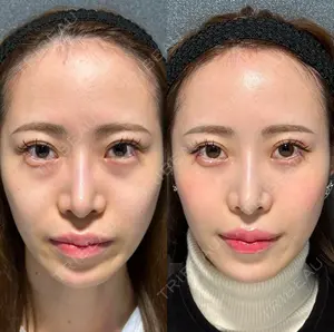 30 days after image