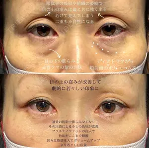 30 days after image