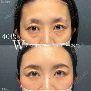 30 days after image
