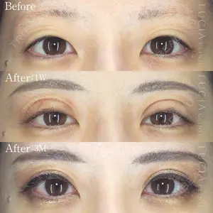 before image