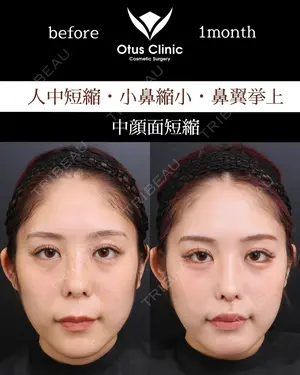 30 days after image