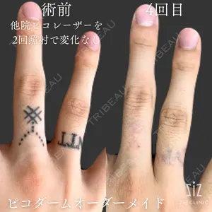 before image
