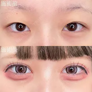 90 days after image