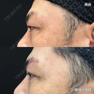 before image