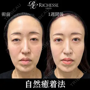 6 days after image