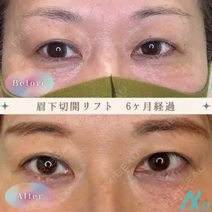 180 days after image