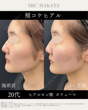 before image
