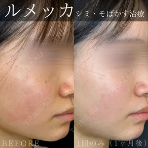 30 days after image