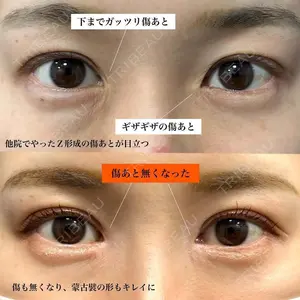 before image