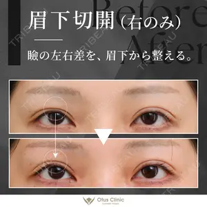 90 days after image