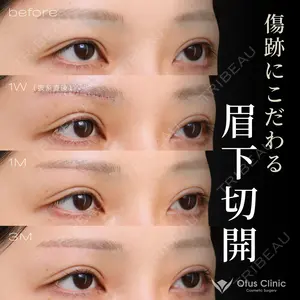 before image