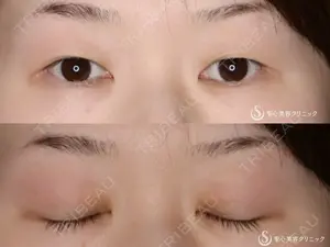 before image